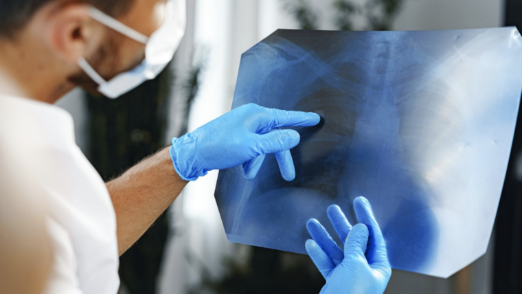 cancérologue au Maroc